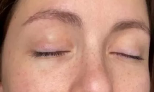 Tâches de rousseurs en dermopigmentation 55€ , à Lyon 2ème, Lyon, L'Embellie - Centre de Beauté