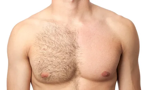 Séance d'épilation complète pour homme à Lyon, Lyon, L'Embellie - Centre de Beauté