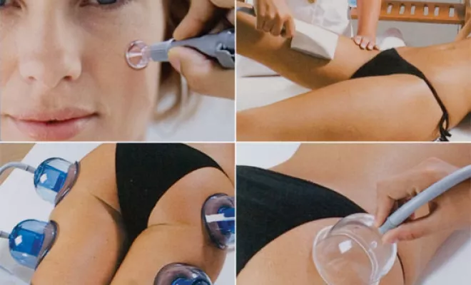 Vos cures anti peau d'orange avec les techniques Starvac et manuelles, Lyon, L'Embellie - Centre de Beauté