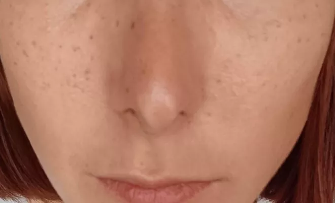 Tâches de rousseurs en dermopigmentation 55€ , à Lyon 2ème, Lyon, L'Embellie - Centre de Beauté