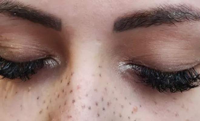 Tâches de rousseurs en dermopigmentation 55€ , à Lyon 2ème, Lyon, L'Embellie - Centre de Beauté