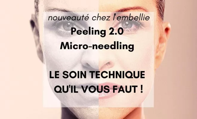 LE MICRONEEDLING : la technique, Lyon, L'Embellie - Centre de Beauté