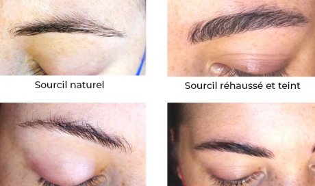 Rehaussement des sourcils à Lyon 69002