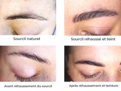 Rehaussement des sourcils à Lyon 69002