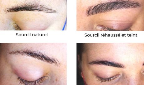 Rehaussement des sourcils à Lyon 69002